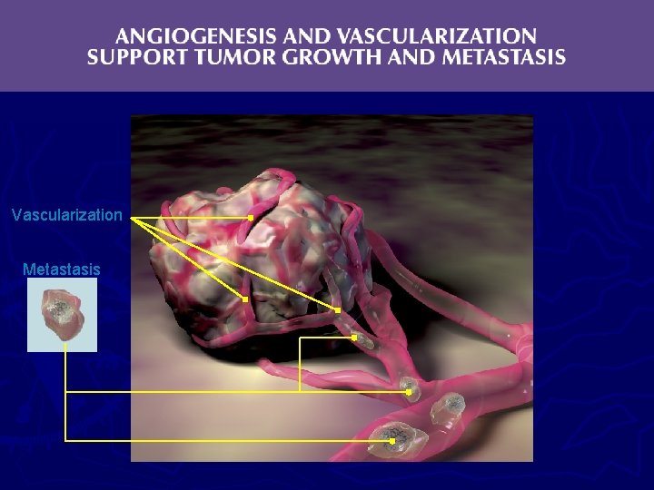 Vascularization Metastasis 