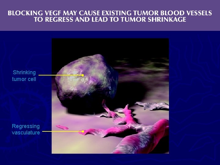 Shrinking tumor cell Regressing vasculature 