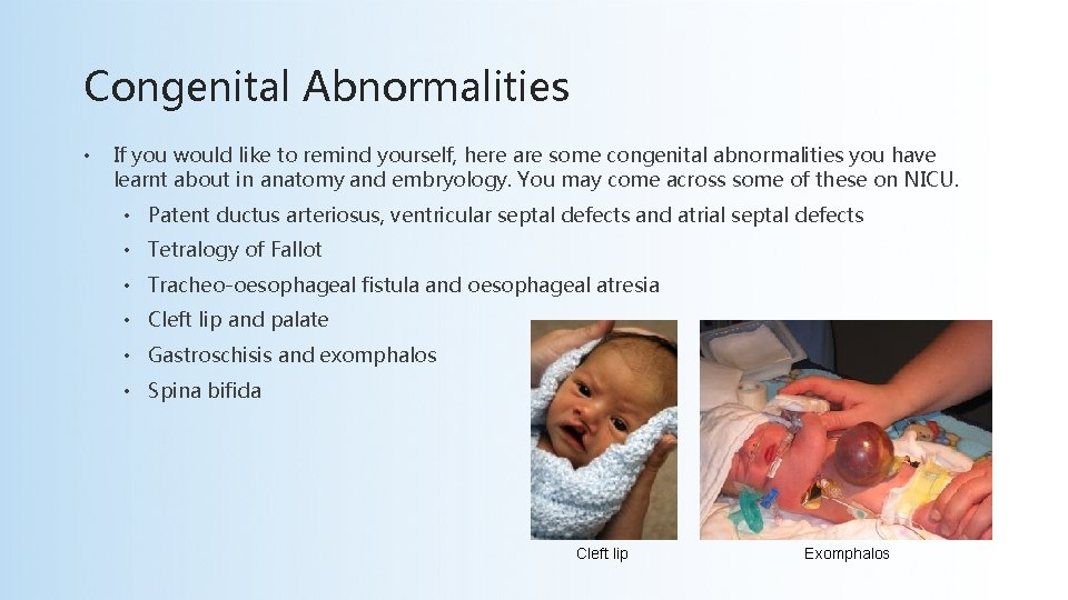 Congenital Abnormalities • If you would like to remind yourself, here are some congenital