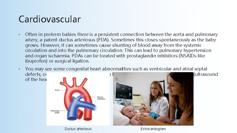 Cardiovascular • Often in preterm babies there is a persistent connection between the aorta
