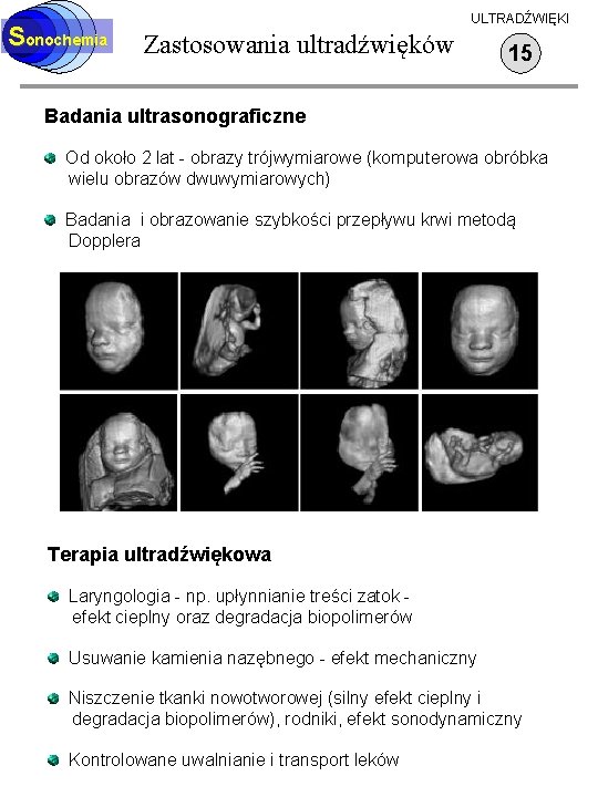 Sonochemia ULTRADŹWIĘKI Zastosowania ultradźwięków 15 Badania ultrasonograficzne Od około 2 lat - obrazy trójwymiarowe