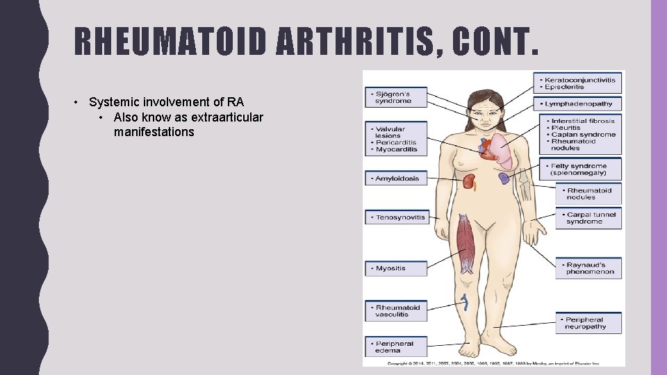 RHEUMATOID ARTHRITIS, CONT. • Systemic involvement of RA • Also know as extraarticular manifestations