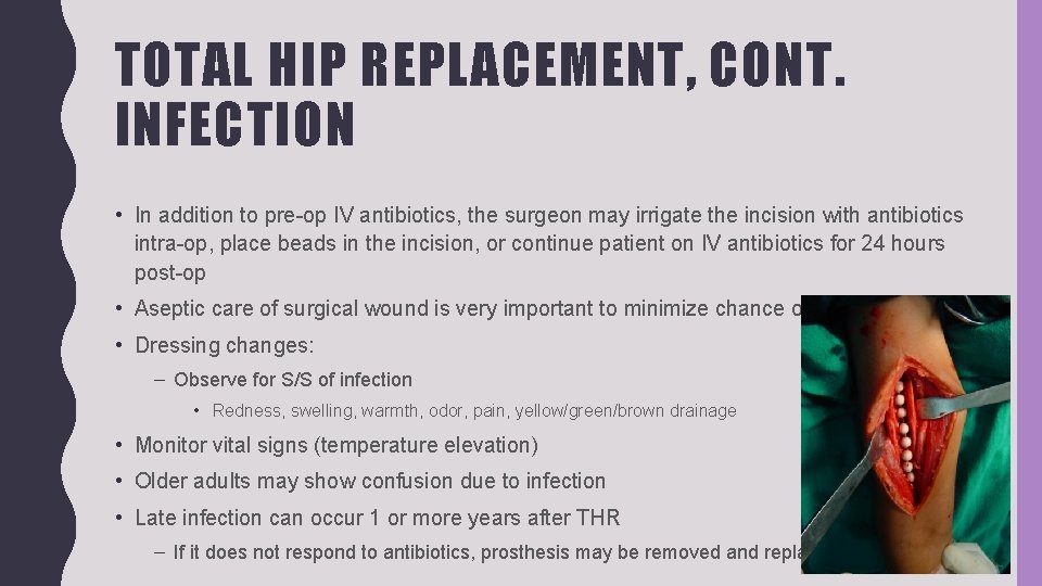 TOTAL HIP REPLACEMENT, CONT. INFECTION • In addition to pre-op IV antibiotics, the surgeon