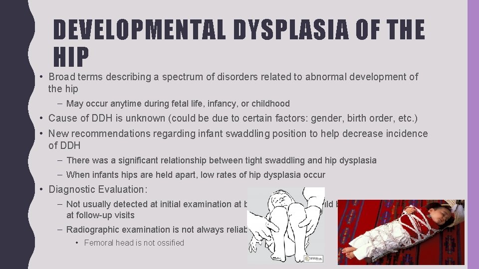 DEVELOPMENTAL DYSPLASIA OF THE HIP • Broad terms describing a spectrum of disorders related