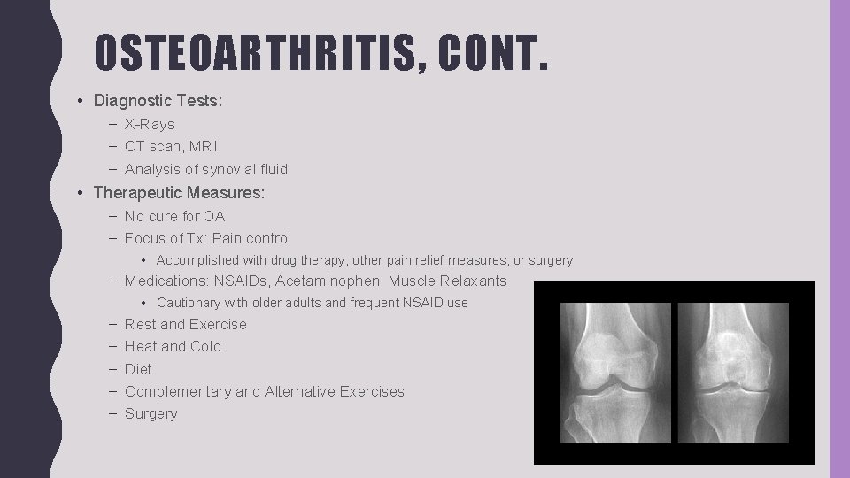 OSTEOARTHRITIS, CONT. • Diagnostic Tests: – X-Rays – CT scan, MRI – Analysis of