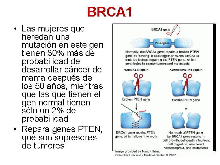 BRCA 1 • Las mujeres que heredan una mutación en este gen tienen 60%