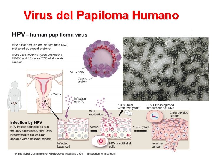 Virus del Papiloma Humano 