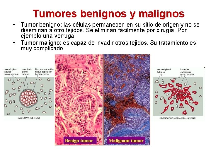 Tumores benignos y malignos • Tumor benigno: las células permanecen en su sitio de