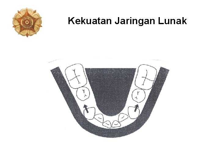 Kekuatan Jaringan Lunak 