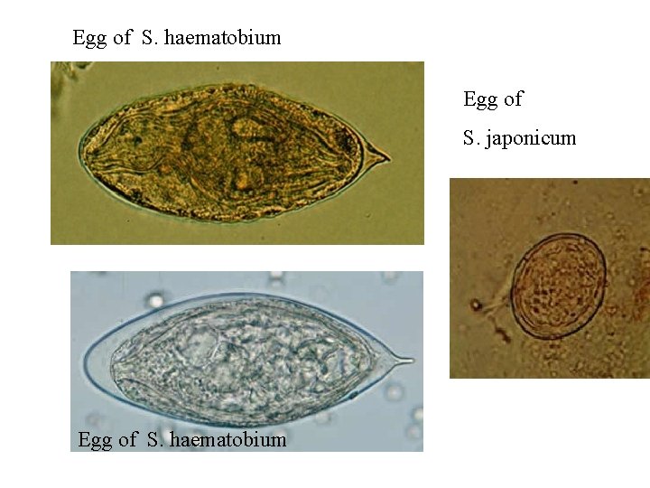 Egg of S. haematobium Egg of S. japonicum Egg of S. haematobium Egg of S. haematobium Egg of S. japonicum Egg of S. haematobium