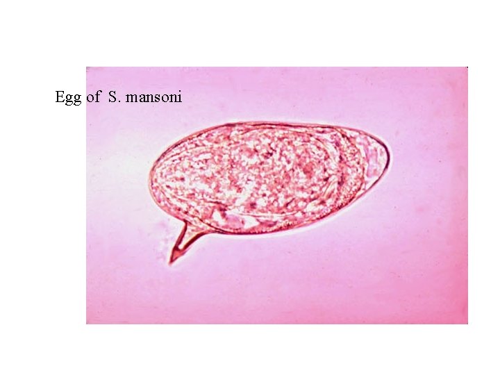 Egg of S. mansoni Egg of S. mansoni