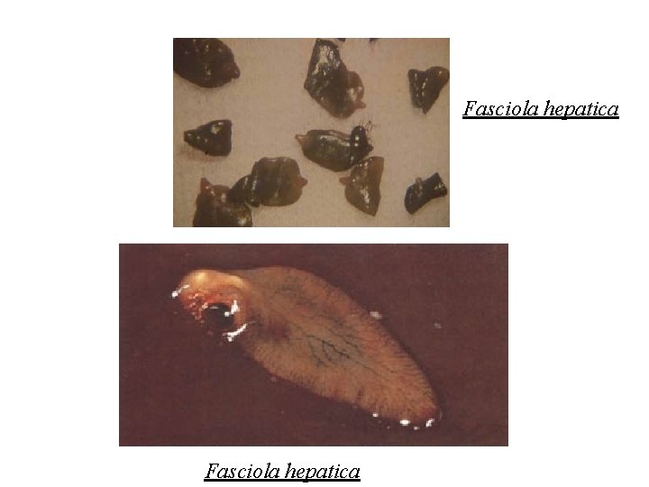 Fasciola hepatica Fasciola hepatica