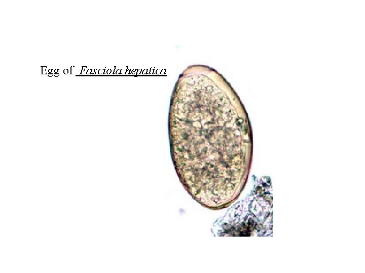 Egg of Fasciola hepatica Egg of Fasciola hepatica
