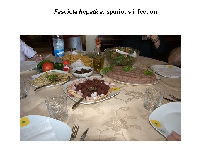 Fasciola hepatica: spurious infection Fasciola hepatica: spurious infection