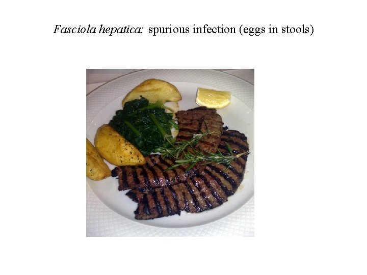 Fasciola hepatica: spurious infection (eggs in stools) Fasciola hepatica: spurious infection (eggs in stools)