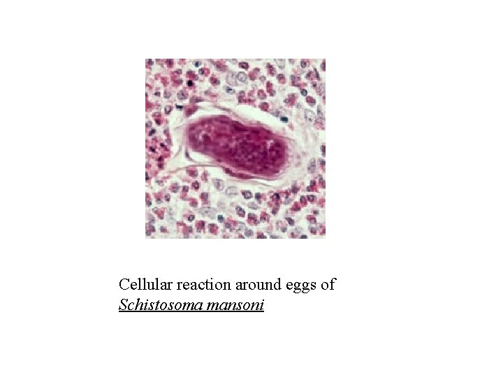 Cellular reaction around eggs of Schistosoma mansoni Cellular reaction around eggs of Schistosoma mansoni