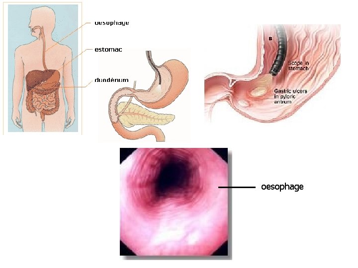 oesophage 