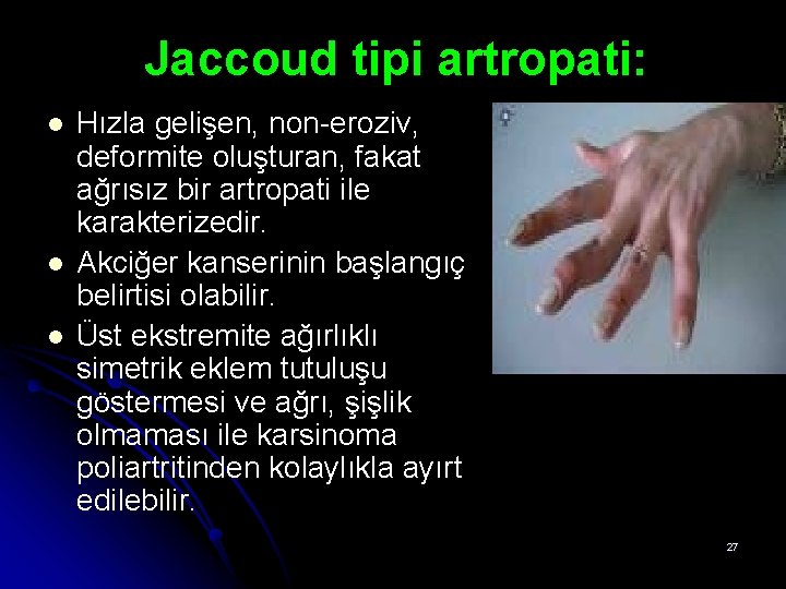 Jaccoud tipi artropati: l l l Hızla gelişen, non-eroziv, deformite oluşturan, fakat ağrısız bir Jaccoud tipi artropati: l l l Hızla gelişen, non-eroziv, deformite oluşturan, fakat ağrısız bir