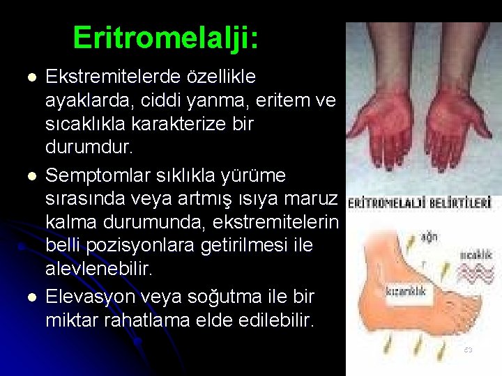 Eritromelalji: l l l Ekstremitelerde özellikle ayaklarda, ciddi yanma, eritem ve sıcaklıkla karakterize bir Eritromelalji: l l l Ekstremitelerde özellikle ayaklarda, ciddi yanma, eritem ve sıcaklıkla karakterize bir