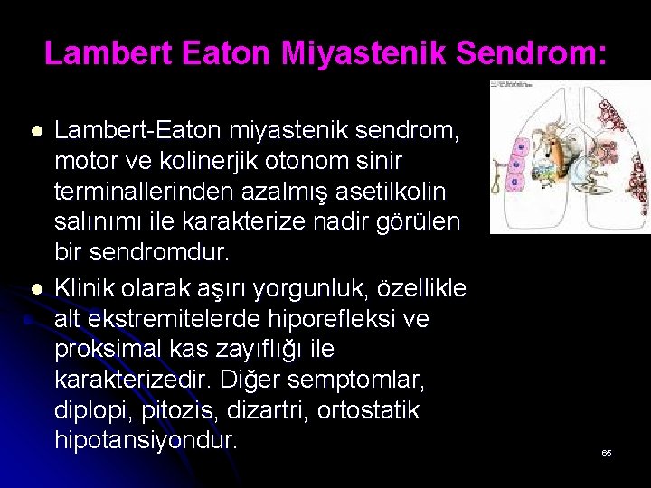 Lambert Eaton Miyastenik Sendrom: l l Lambert-Eaton miyastenik sendrom, motor ve kolinerjik otonom sinir Lambert Eaton Miyastenik Sendrom: l l Lambert-Eaton miyastenik sendrom, motor ve kolinerjik otonom sinir