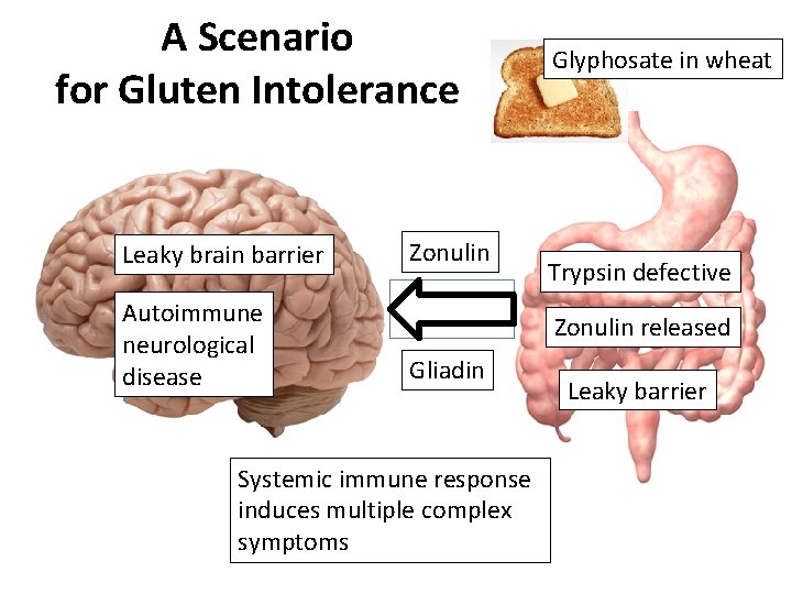 A Scenario for Gluten Intolerance Leaky brain barrier Autoimmune neurological disease Zonulin Glyphosate in A Scenario for Gluten Intolerance Leaky brain barrier Autoimmune neurological disease Zonulin Glyphosate in