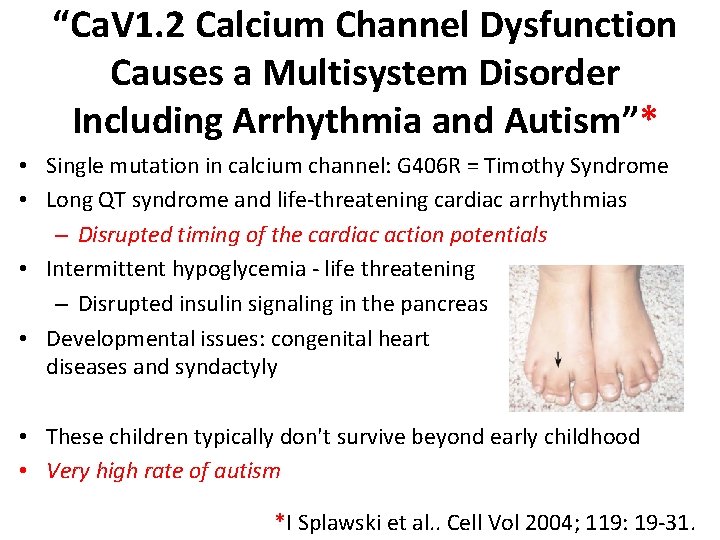 “Ca. V 1. 2 Calcium Channel Dysfunction Causes a Multisystem Disorder Including Arrhythmia and “Ca. V 1. 2 Calcium Channel Dysfunction Causes a Multisystem Disorder Including Arrhythmia and