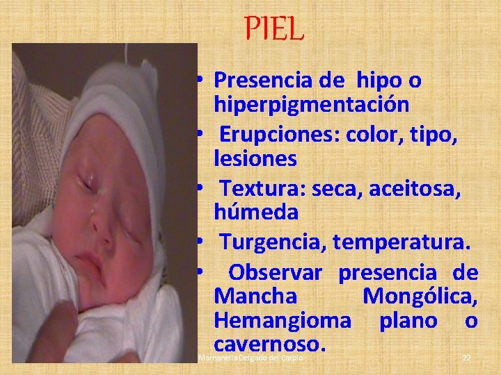 PIEL • Presencia de hipo o hiperpigmentación • Erupciones: color, tipo, lesiones • Textura: PIEL • Presencia de hipo o hiperpigmentación • Erupciones: color, tipo, lesiones • Textura: