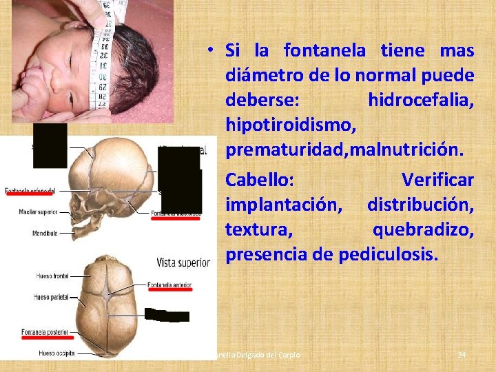 • Si la fontanela tiene mas diámetro de lo normal puede deberse: hidrocefalia, • Si la fontanela tiene mas diámetro de lo normal puede deberse: hidrocefalia,