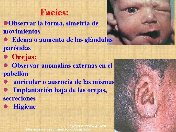Facies: l. Observar la forma, simetría de movimientos l Edema o aumento de las Facies: l. Observar la forma, simetría de movimientos l Edema o aumento de las