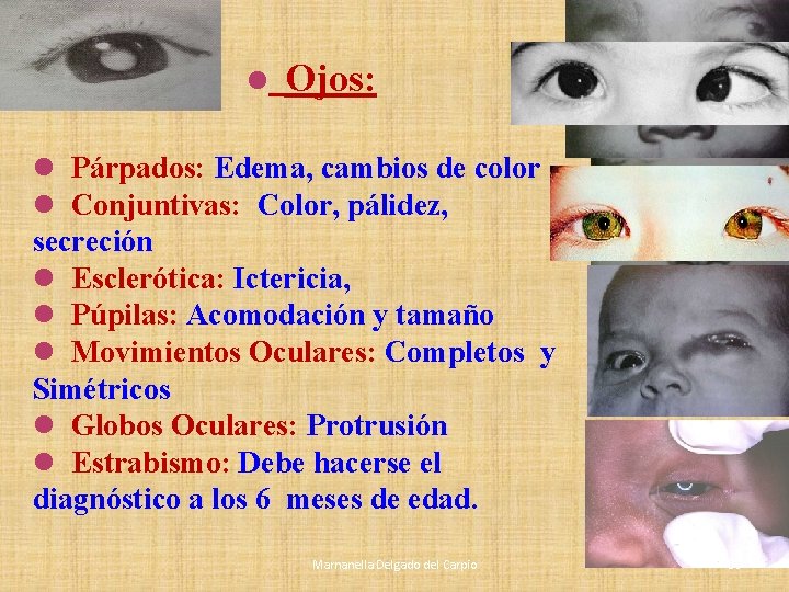 l Ojos: l Párpados: Edema, cambios de color l Conjuntivas: Color, pálidez, secreción l l Ojos: l Párpados: Edema, cambios de color l Conjuntivas: Color, pálidez, secreción l