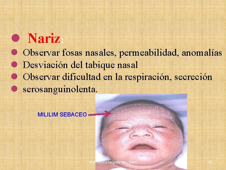 l Nariz: l l Observar fosas nasales, permeabilidad, anomalías Desviación del tabique nasal Observar l Nariz: l l Observar fosas nasales, permeabilidad, anomalías Desviación del tabique nasal Observar