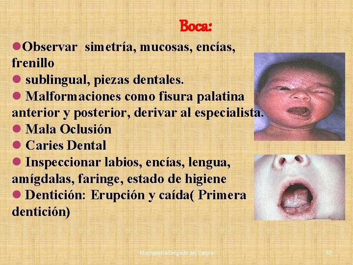 Boca: l. Observar simetría, mucosas, encías, frenillo l sublingual, piezas dentales. l Malformaciones como Boca: l. Observar simetría, mucosas, encías, frenillo l sublingual, piezas dentales. l Malformaciones como