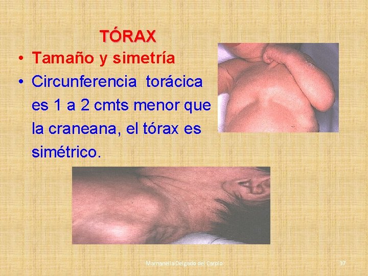 TÓRAX • Tamaño y simetría • Circunferencia torácica es 1 a 2 cmts menor TÓRAX • Tamaño y simetría • Circunferencia torácica es 1 a 2 cmts menor