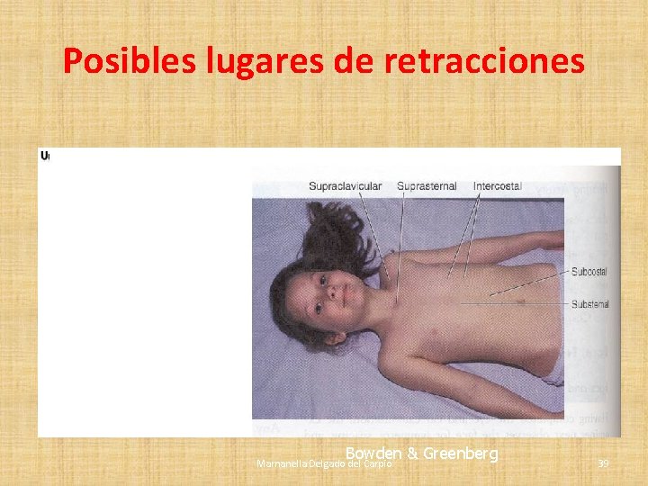 Posibles lugares de retracciones Observe mientras el infant o niño esta quieto. Bowden & Posibles lugares de retracciones Observe mientras el infant o niño esta quieto. Bowden &