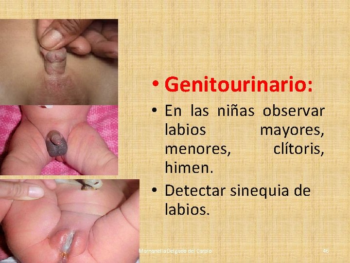 • Genitourinario: • En las niñas observar labios mayores, menores, clítoris, himen. • • Genitourinario: • En las niñas observar labios mayores, menores, clítoris, himen. •