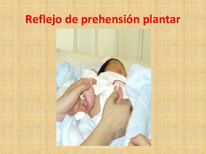 Reflejo de prehensión plantar Marnanella Delgado del Carpio 66 Reflejo de prehensión plantar Marnanella Delgado del Carpio 66