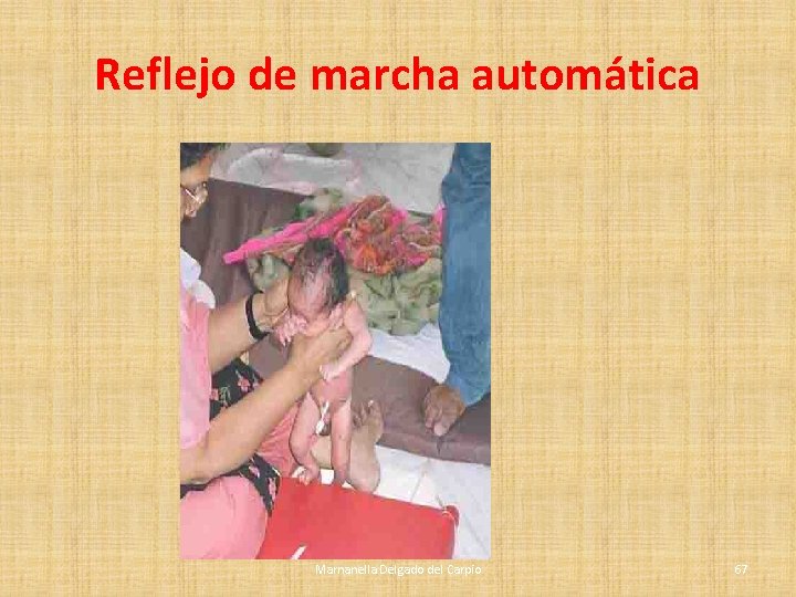 Reflejo de marcha automática Marnanella Delgado del Carpio 67 Reflejo de marcha automática Marnanella Delgado del Carpio 67