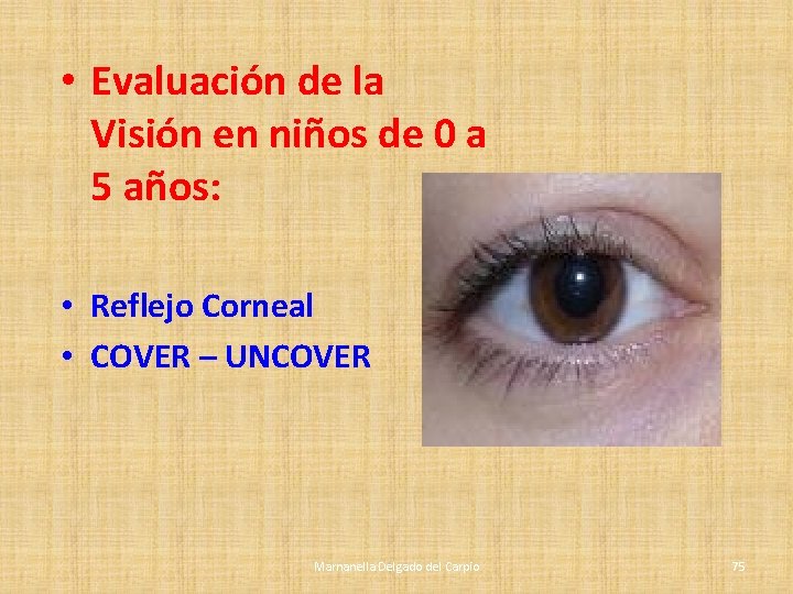 • Evaluación de la Visión en niños de 0 a 5 años: • • Evaluación de la Visión en niños de 0 a 5 años: •