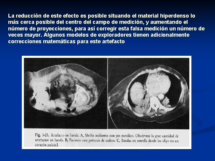 La reducción de este efecto es posible situando el material hiperdenso lo más cerca