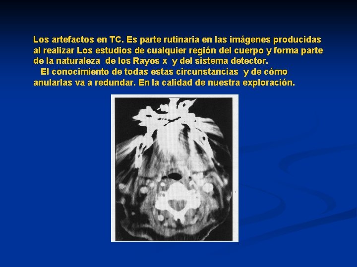 ARTEFACTOS EN IMGENES DE TOMOGRAFIA COMPUTARIZADA Tc Rad ARTEFACTOS EN IMGENES DE TOMOGRAFIA COMPUTARIZADA Tc Rad