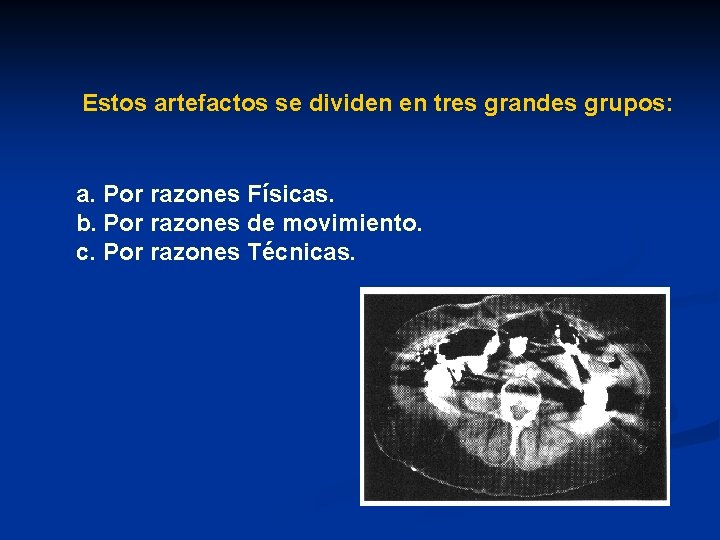 Estos artefactos se dividen en tres grandes grupos: a. Por razones Físicas. b. Por