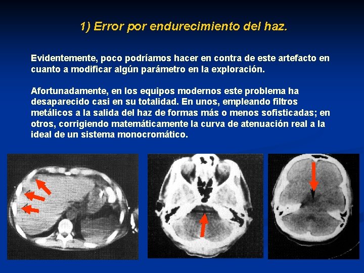 1) Error por endurecimiento del haz. Evidentemente, poco podríamos hacer en contra de este
