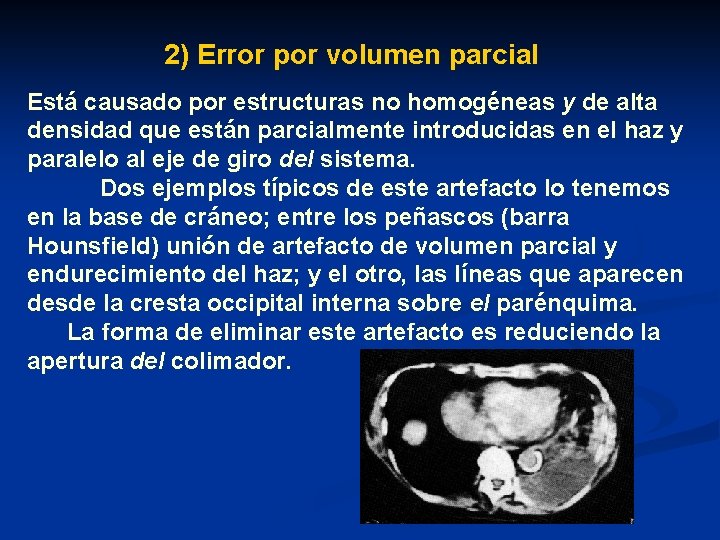 2) Error por volumen parcial Está causado por estructuras no homogéneas y de alta
