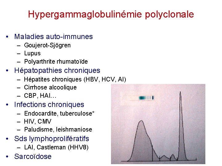 Hypergammaglobulinémie polyclonale • Maladies auto-immunes – Goujerot-Sjögren – Lupus – Polyarthrite rhumatoïde • Hépatopathies