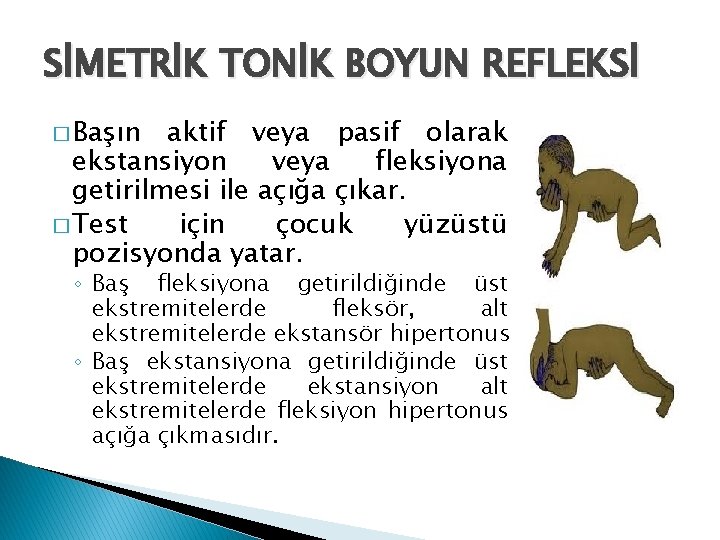 SİMETRİK TONİK BOYUN REFLEKSİ � Başın aktif veya pasif olarak ekstansiyon veya fleksiyona getirilmesi