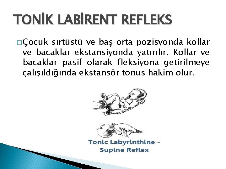TONİK LABİRENT REFLEKS � Çocuk sırtüstü ve baş orta pozisyonda kollar ve bacaklar ekstansiyonda