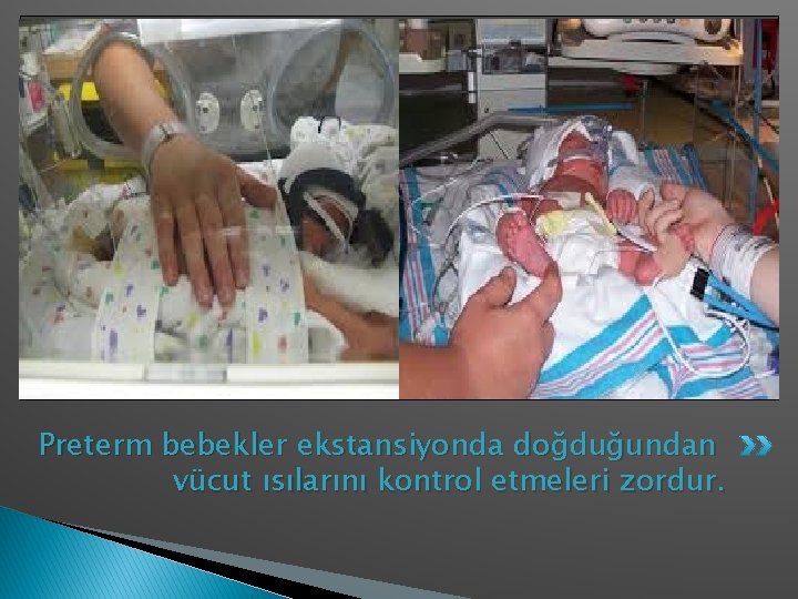 Preterm bebekler ekstansiyonda doğduğundan vücut ısılarını kontrol etmeleri zordur. 