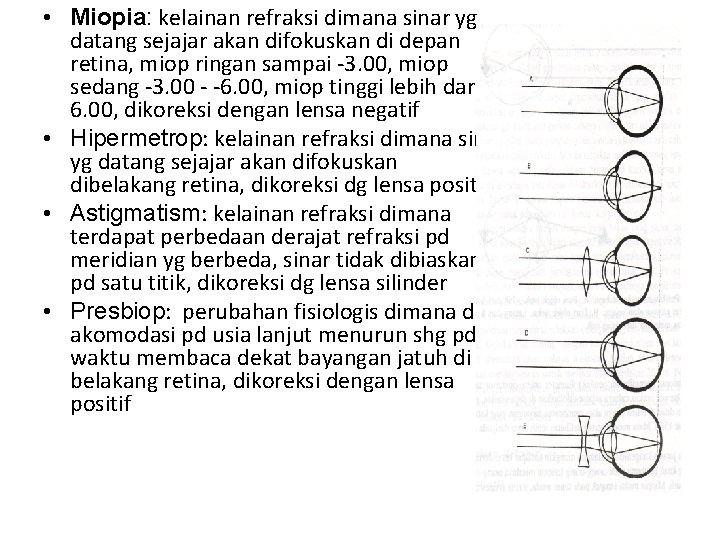 • Miopia: kelainan refraksi dimana sinar yg datang sejajar akan difokuskan di depan • Miopia: kelainan refraksi dimana sinar yg datang sejajar akan difokuskan di depan