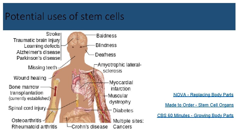 Potential uses of stem cells NOVA - Replacing Body Parts Made to Order -