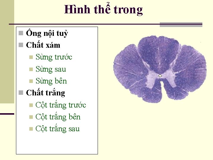 Hình thể trong n Ống nội tuỷ n Chất xám Sừng trước n Sừng